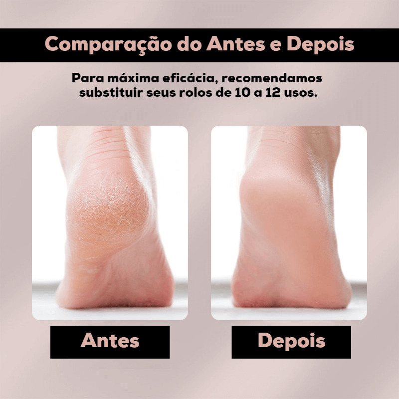 Removedor de Rachaduras Recarregável NewFeet